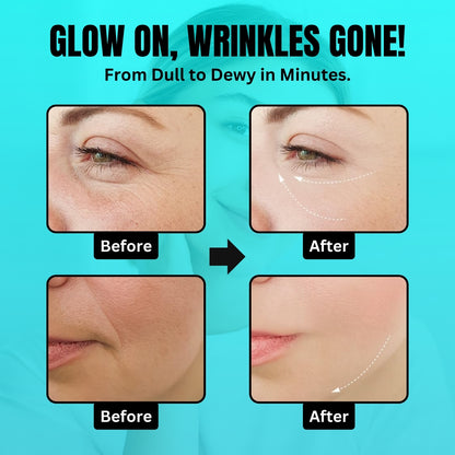 Veluxir Fine Line & Wrinkle Facial Sculptor